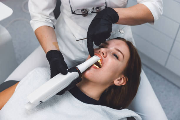 Best Broken or Chipped Tooth Repair in USA